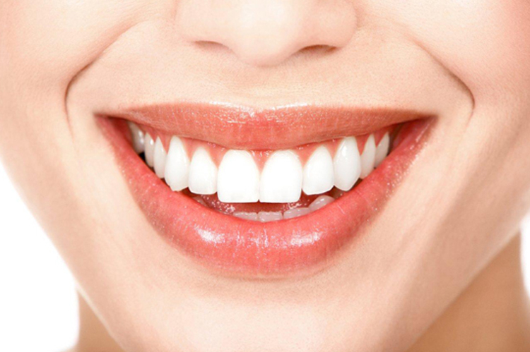 Răng sứ HT Smile 2